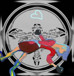 Tamara K. E., o. T. (aus der Serie: Revisiting Fear), 2018